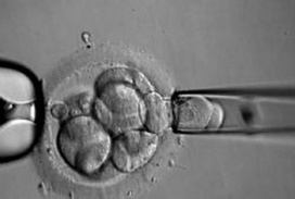 2025年拉拉去河北燕达医院做一次试管需要多少钱？附价格内容